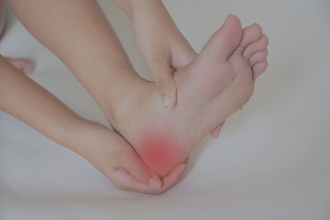 The Complete Guide to Plantar Fasciitis: Causes, Symptoms, Treatment &amp; Recovery